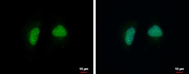 ADPRHL1 Antibody