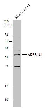 ADPRHL1 Antibody