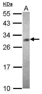 CHAC1 Antibody