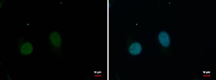 GPBP1L1 Antibody
