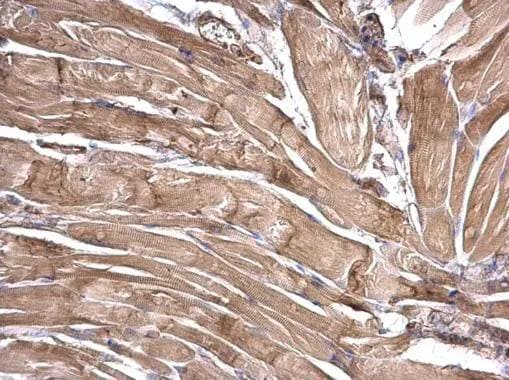 LRRFIP2 Antibody