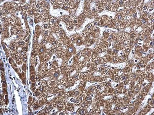 MAGEE2 Antibody