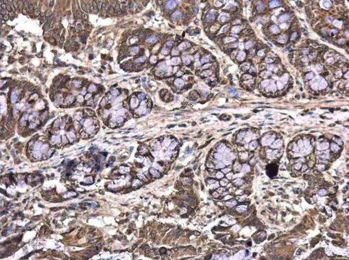 MAGEE2 Antibody