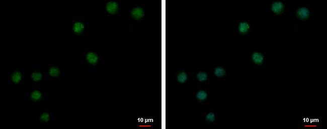 ZNF257 Antibody