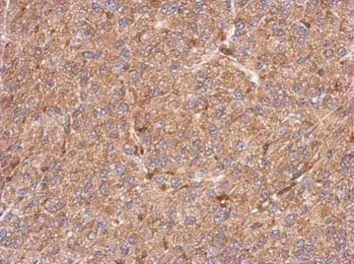 CCDC105 Antibody