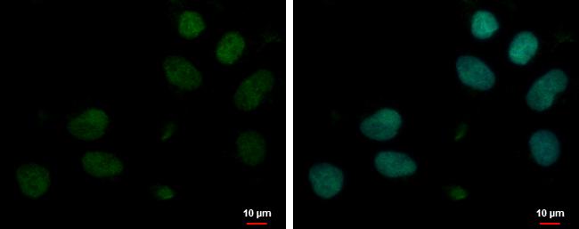 MYT1L Antibody