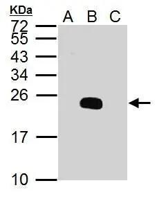 Dengue Virus 2 premembrane (prM) Envelope Antibody