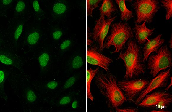 CDYL2 Antibody