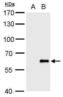 Influenza B Antibody