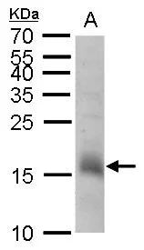 CHAC2 Antibody