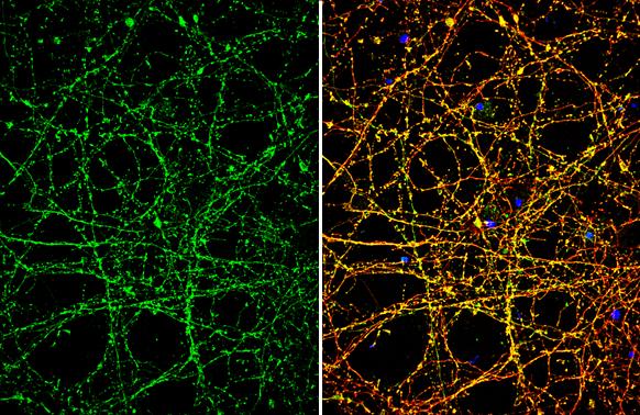 Nav1.7 Antibody
