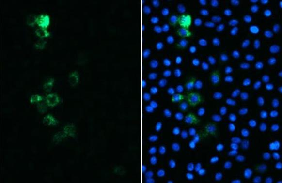 SARS Spike Protein Antibody (1A9)
