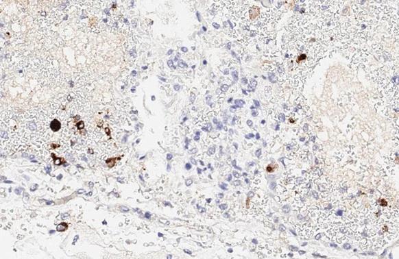 SARS Spike Protein Antibody (1A9)