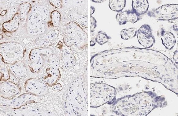 SARS Spike Protein Antibody (1A9)