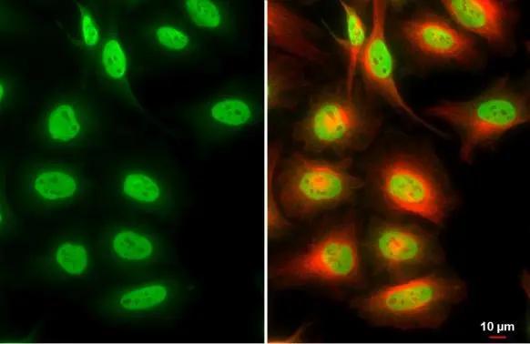 BRM Antibody (HL1114)