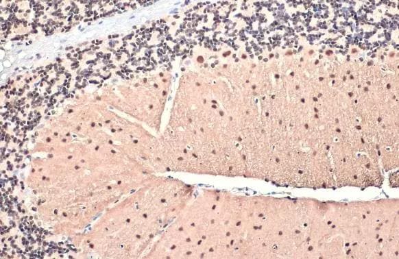 BRM Antibody (HL1114)