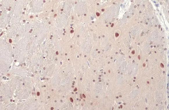 BRM Antibody (HL1114)