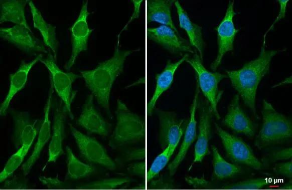 RRM2 Antibody (HL1235)