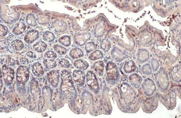 RRM2 Antibody (HL1235)