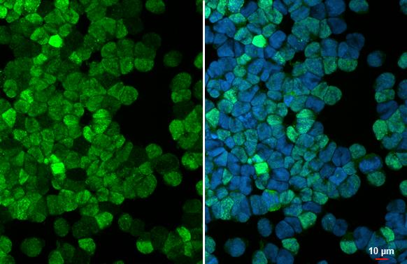 PDE6D Antibody (HL1359)