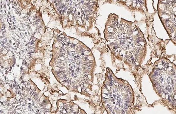 PDE6D Antibody (HL1359)