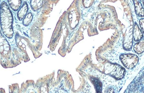 PDE6D Antibody (HL1359)