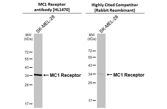 Melanocortin-1 R/MC1R Antibody (HL1470)