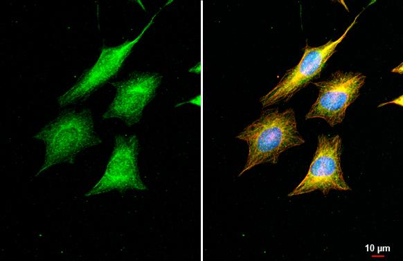 DNA Polymerase beta Antibody (HL1512)
