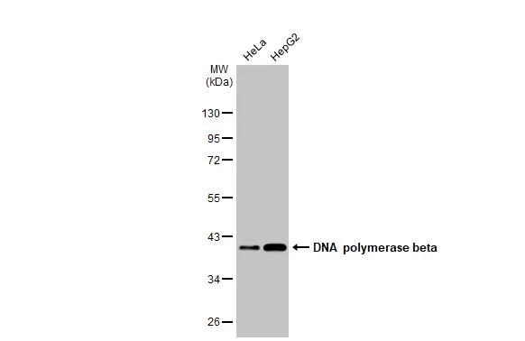 DNA Polymerase beta Antibody (HL1512)