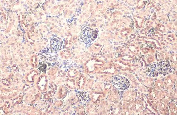 Puromycin-sensitive aminopeptidase/NPEPPS Antibody (HL1531)