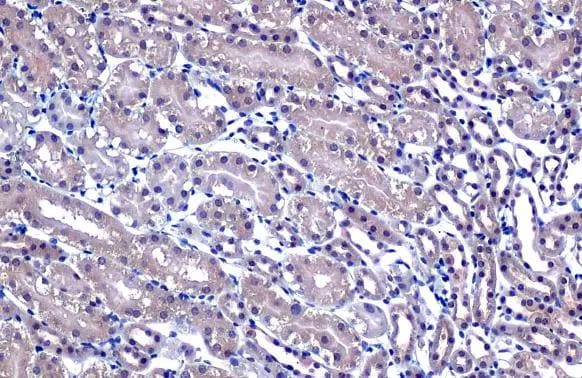 Puromycin-sensitive aminopeptidase/NPEPPS Antibody (HL1531)