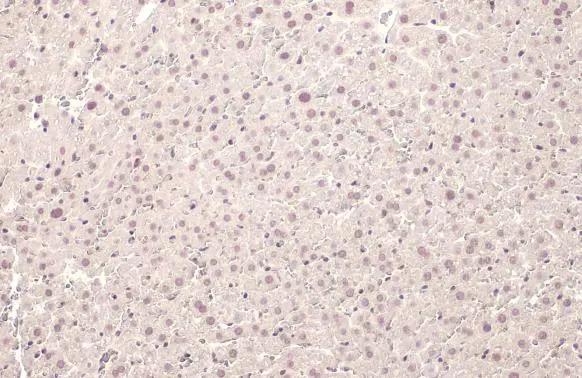 U2AF2 Antibody (HL1583)
