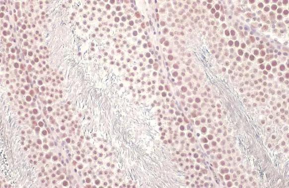 U2AF2 Antibody (HL1583)