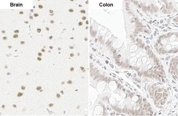 U2AF2 Antibody (HL1583)