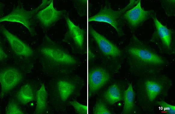 STAM-1 Antibody (HL1637)