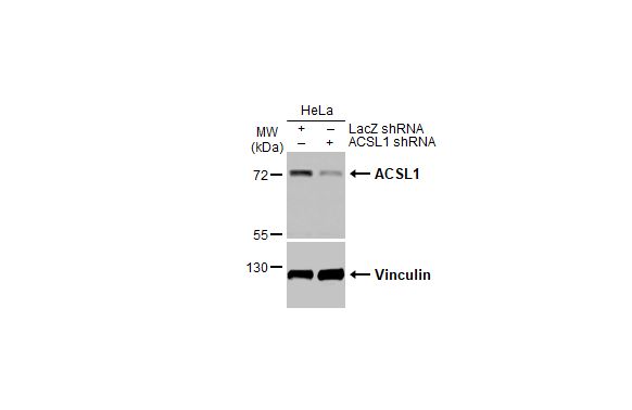 ACSL1 Antibody (HL1651)