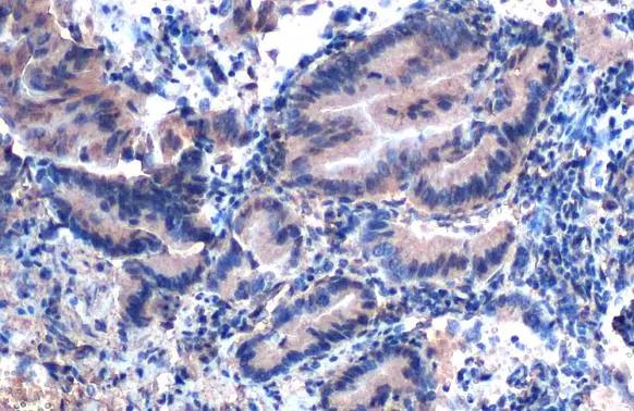 integrin beta 4 binding protein Antibody (HL1758)
