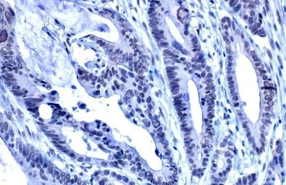 ADAR Antibody (HL1789)