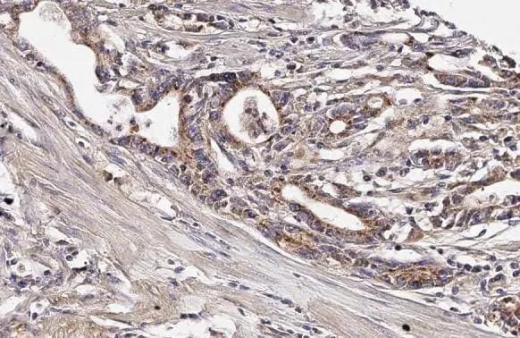 mtTFA Antibody (HL2012)