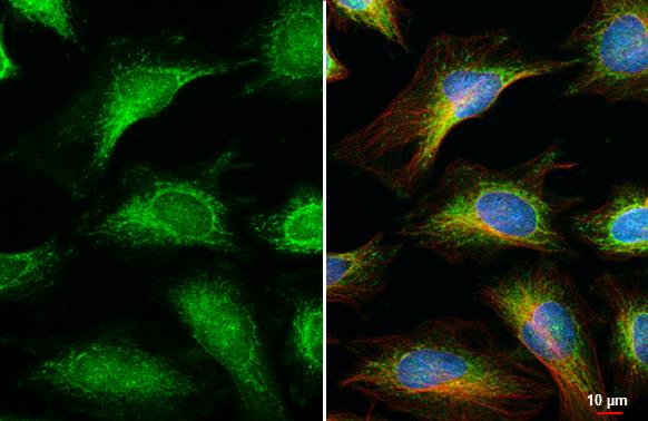 OGDH Antibody (HL2072)