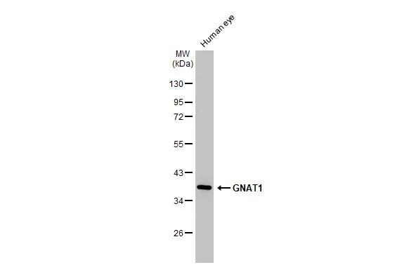 Transducin alpha Antibody (HL2126)