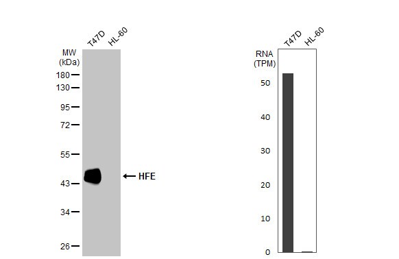 HFE Antibody (HL2155)