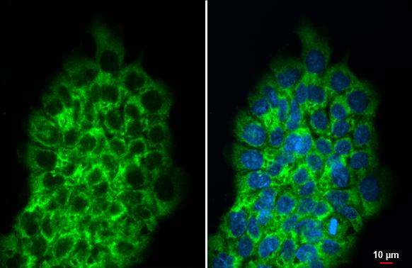 RPLP2 Antibody (HL2256)