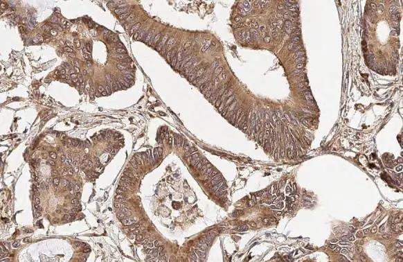RPLP2 Antibody (HL2256)