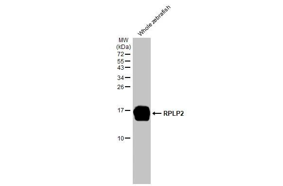 RPLP2 Antibody (HL2256)