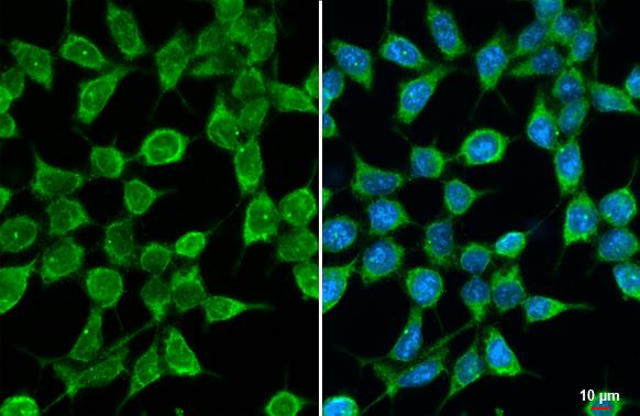 GPS2 Antibody (HL2276)