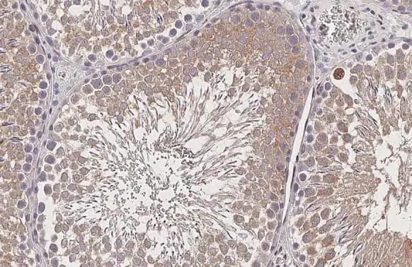 GPS2 Antibody (HL2276)