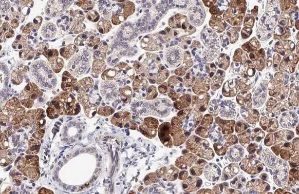GPS2 Antibody (HL2276)
