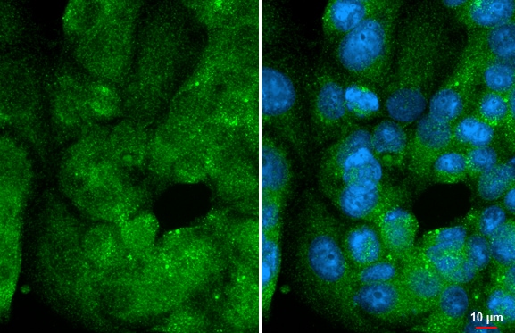 DUSP8 Antibody (HL2338)
