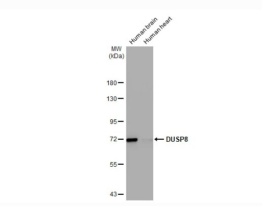 DUSP8 Antibody (HL2338)